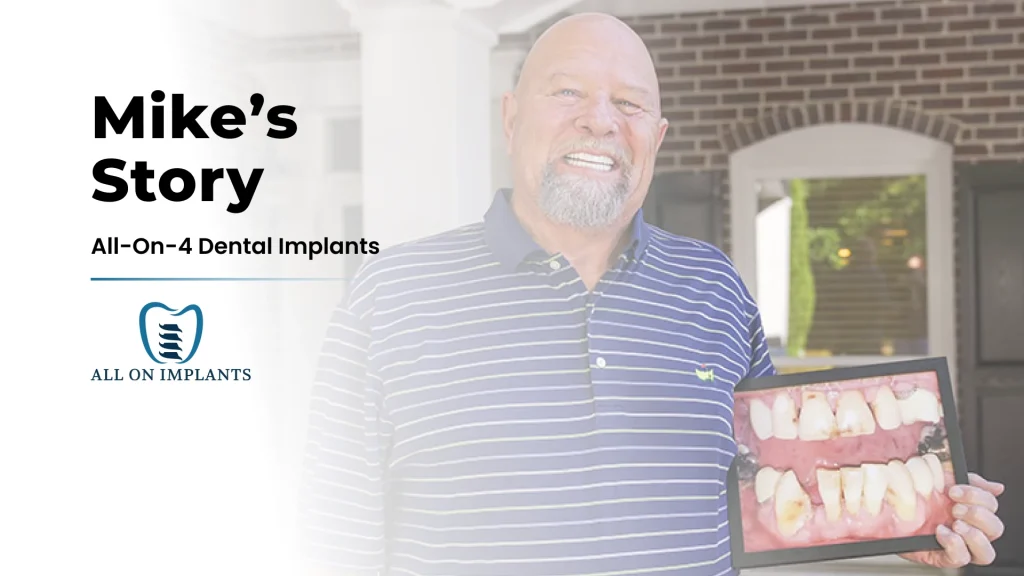 Thumbnail for a video about Mike's Story at All On Implants