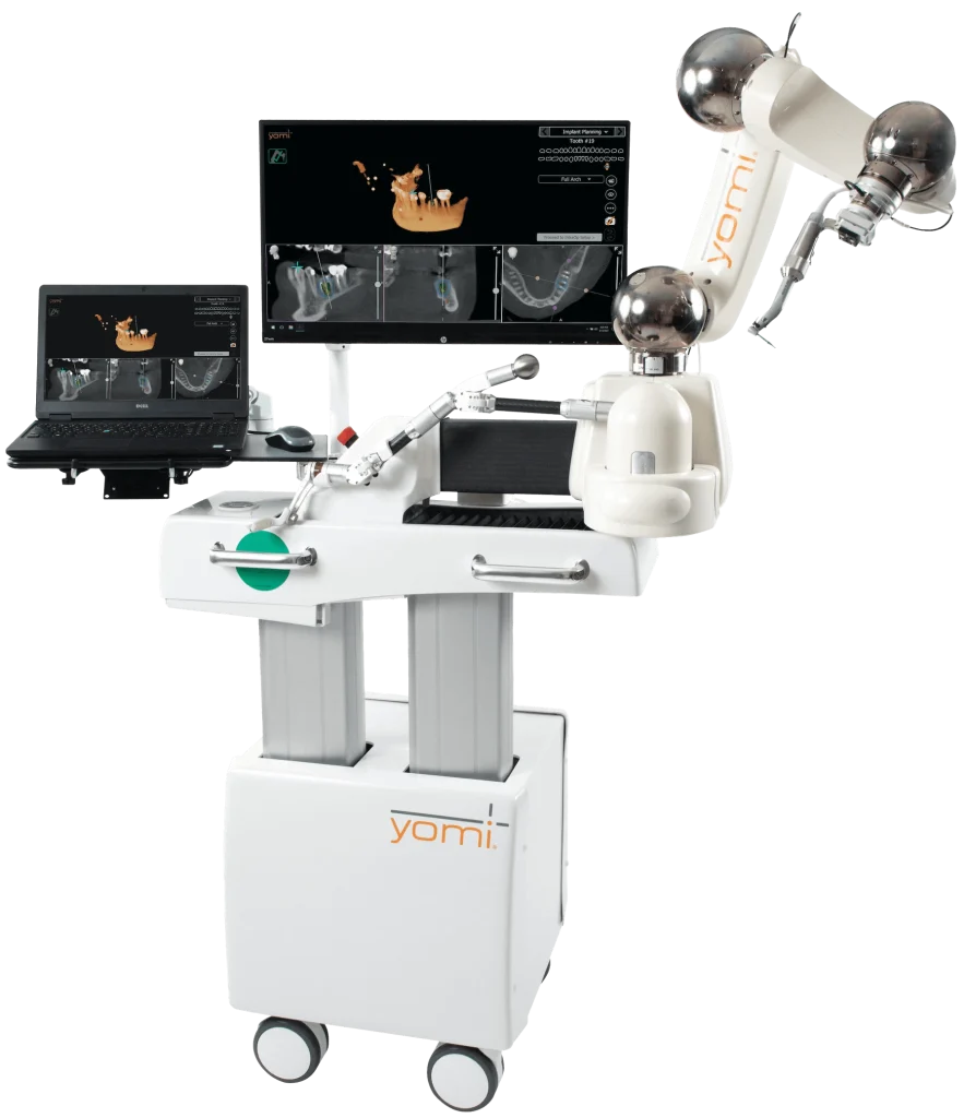 Yomi robotics system for guided dental implant placement